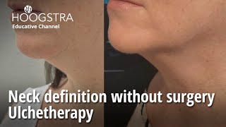 Neck definition without surgery  Ulchetherapy  24120 [upl. by Nalo]