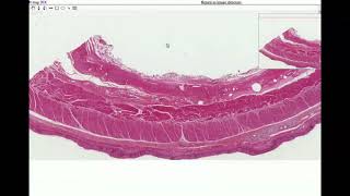 Anatomy  Histology of the Esophagus [upl. by Iain]