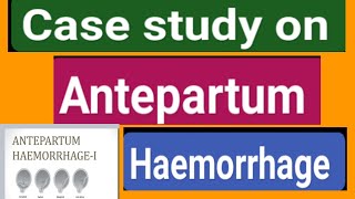 Case study on Antepartum haemorrhage videosyoutubevideosviral [upl. by Maurie]