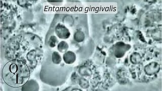 7 Entamoeba gingivalis [upl. by Egon]