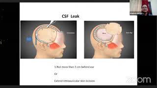 Decompressive Craniectomy  Complications and Avoidance [upl. by Aseen]