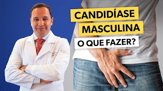 Como se livrar da CANDIDÍASE MASCULINA rapidamente [upl. by Wiles]