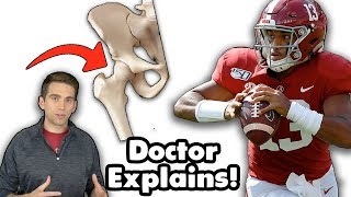 Doctor Explains Tua Tagovailoa Hip Dislocation Injury and Compares to Bo Jackson [upl. by Eanej601]