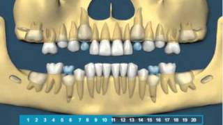 Eruption Teethmp4 [upl. by Melessa]