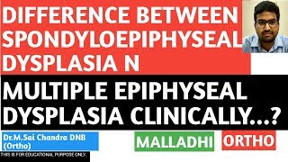 DIFF BETWEEN SPONDYLOEPIPHYSEAL AND MULTIPLE EPIPHYSEAL DYSPLASIA [upl. by Cirderf]