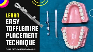 How to place Tofflemire matrix band  easy steps [upl. by Hamid602]