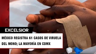 Viruela del mono Reportan seis casos más en una semana en México [upl. by Edi]