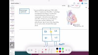 Eisenmenger syndrome cardiology 63  First Aid USMLE Step 1 in UrduHindi [upl. by Lynden]