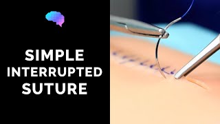 Simple interrupted suture wound suturing  OSCE Guide  UKMLA  CPSA [upl. by Cullie738]