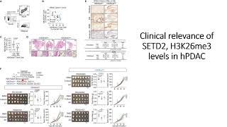 Clinical relevance of SETD2 H2K36me3 levels in hPDAC human pancreatic adenocarcinoma Code 736 [upl. by Atiek663]