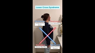 Upper and Lower Cross Syndrome [upl. by Alliuqahs500]