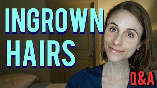 Ingrown hairs how to get rid of them amp skin care tips Dr Dray [upl. by Acassej]