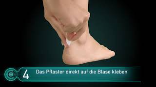 Wie wende ich Compeed Blasenpflaster richtig an [upl. by Richara]