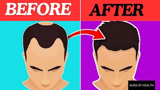 10 PROVEN Tips To REGROW Hair FAST  🚫 WITHOUT Surgery [upl. by Sesiom994]