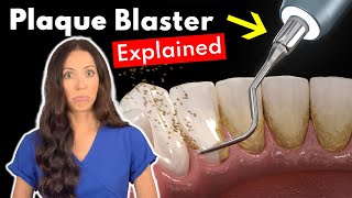 Dental Hygienist Explains Ultrasonic Scaling  Teeth Cleaning With Plaque Blaster [upl. by Paymar97]