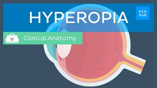 Farsightedness Hyperopia Definition causes symptoms diagnosis and treatment  Kenhub [upl. by Eijneb]