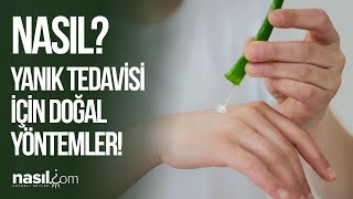 YANIĞA NE İYİ GELİR NASIL GEÇER İŞTE EVDE UYGULAYABİLECEĞİNİZ PRATİK VE DOĞAL YÖNTEMLER yanık [upl. by Niwrehs489]