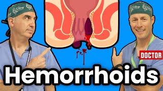 How To Get Rid Of Hemorrhoids [upl. by Inkster573]