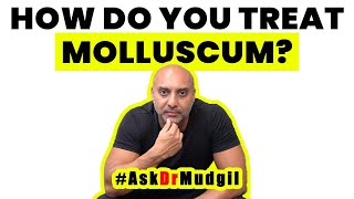 HOW DO YOU TREAT MOLLUSCUM [upl. by Suidaht]