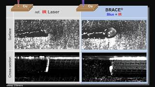 BRACE vs IR Laser [upl. by Selin]