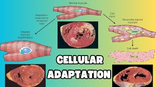 Diferencias de Atrofia y metaplasia Celular en 2 minutos  Adaptacion Celular  Homeostasis [upl. by Anoyek]