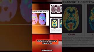 LabGrown artificial Mini brainfacts amazingfacts healthadvice gk hindi [upl. by Jerald]