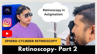 Retinoscopy Part 2  Static Retinoscopy for astigmatism  SpheroCylinder method [upl. by Greer]