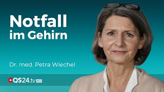 Gefahr im Gehirn Alles was Sie über den Schlaganfall wissen müssen  Visite  QS24 [upl. by Oterol]