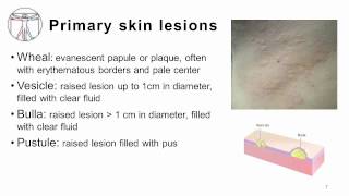 4 Primary and Secondary skin lesions [upl. by Dorise]