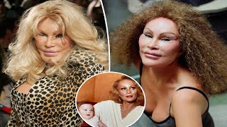 ‘Catwoman’ Jocelyn Wildenstein reveals her original face in shocking throwback photo [upl. by Leoj]