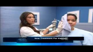 Keloid amp Hypertrophic Scar treatment using Cryoshape on quotThe Doctors TVquot [upl. by Animrac]