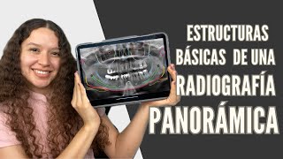 Identificando estructuras de una radiografía panorámica u ortopantomografia  Odontologia con Cri [upl. by Nasia752]