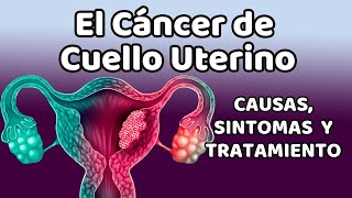 CÁNCER DE CUELLO UTERINO Causas signos y síntomas diagnóstico y tratamiento [upl. by Kerns432]