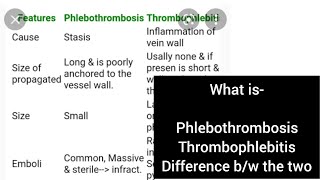 Phlebothrombosis Thrombophlebitis Pathology Second year mbbs [upl. by Rodenhouse]