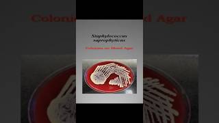 Staphylococcus saprophyticus  colony on blood agar [upl. by Odine497]