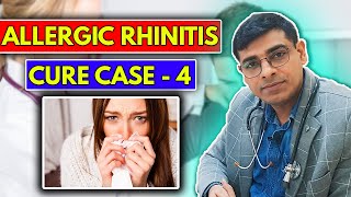 Allergic Rhinitis CURE Case No 4  Homeopathy Treatment for Allergic Rhinitis  Dr Abhik Ghosh [upl. by Armillia]