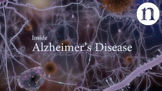 Inside Alzheimer’s disease [upl. by Llebiram]