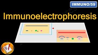 Immunoelectrophoresis FLImmuno59 [upl. by Neyr]