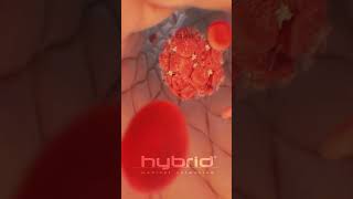 Venous thromboembolism  Deep vein thrombosis DVT  thrombosis medicalanimation bloodclot [upl. by Aiciram397]