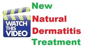 Stasis dermatitis treatment Dermatology doctor Dermatology specialist [upl. by Nikolaos]