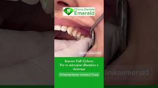 Kurore Zirkoni per dhembe te demtuar wwwemeraldentalcom crowns veneers cosmeticdentistry [upl. by Eustazio]