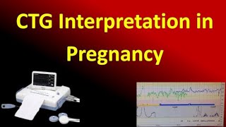 Interpretation of Cardiotocography for Assessment of Fetal Wellbeing NICE Guideline [upl. by Oster165]