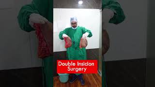 Double Insicion surgery cost  Double Insicion surgery Short shortvideo independenceday [upl. by Sitnalta]