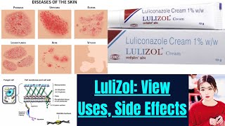 lulizole Cream Ultimate Anti fungal Solution and uses side working properties thepharmacistdrx [upl. by Karylin]