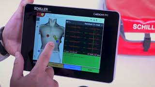 ECG SCHILLER Cardiovit FT1  Touchscreen ECG [upl. by Bernt]