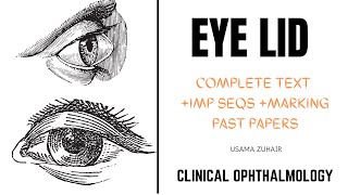 Eyelid Ophthalmology  Text  Past Papers Eyelid Diseases  Chalazion Hordeolum Ectropion Ptosis [upl. by Eiramave]