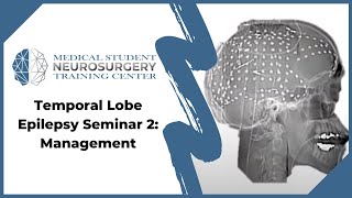 Temporal Lobe Epilepsy Seminar 2 Management [upl. by Ile]