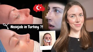 I Got a Nose Job in Istanbul  Turkey Rhinoplasty Vlog 2024 [upl. by Ullyot975]