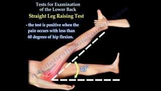 Tests For Examination Of The Lower Back  Everything You Need To Know  Dr Nabil Ebraheim [upl. by Yttisahc]