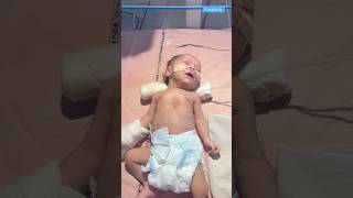 Newborn baby video medical viralvideo [upl. by Tebor]